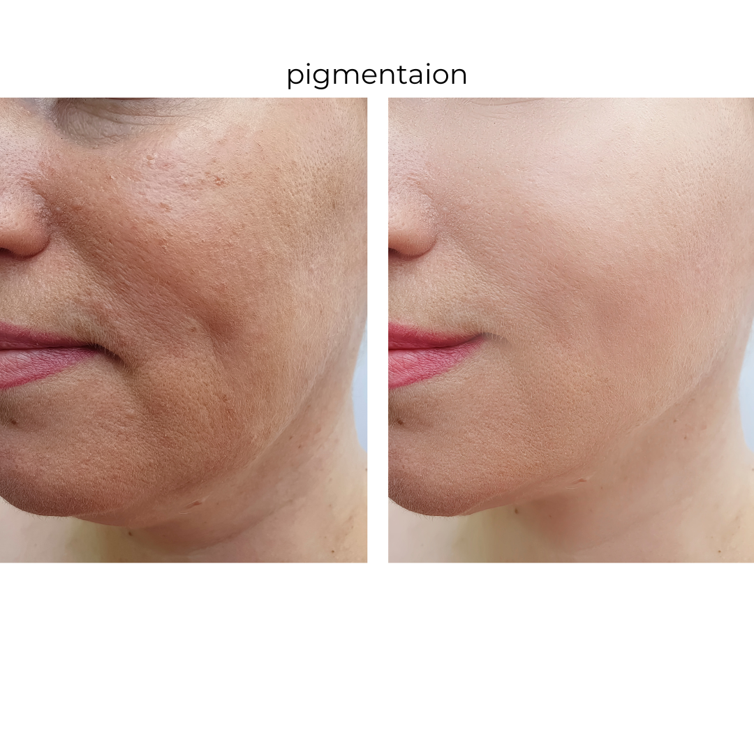 What products to choose for your pigmentation concern.