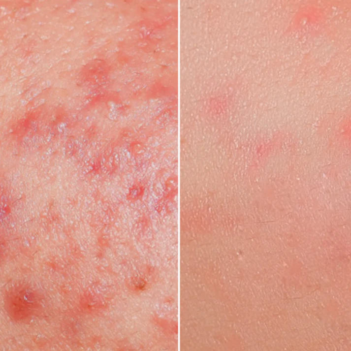 Fau Skin Solution SOS Ampoule - Skin Essence by Kathy