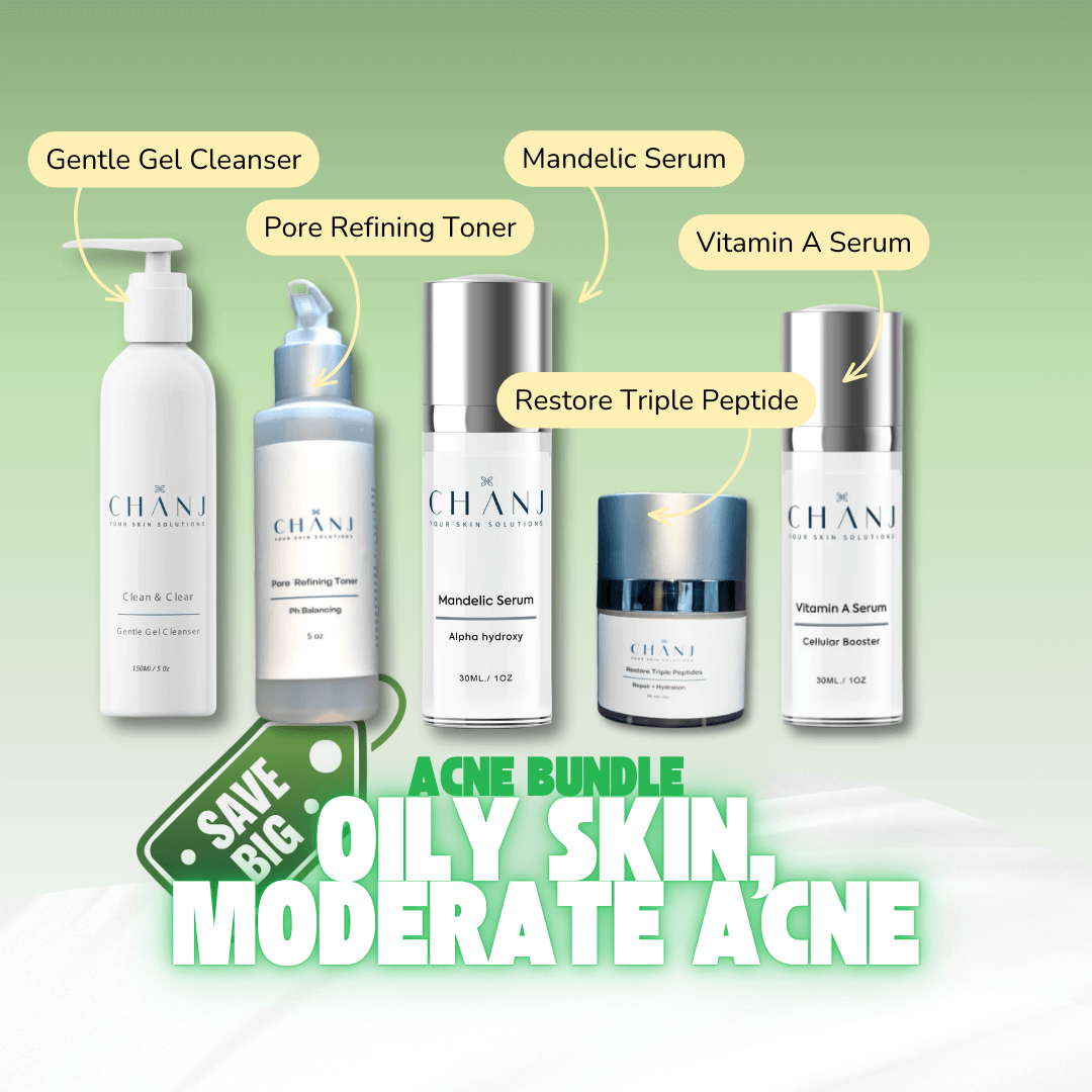 Chanj - Acne Bundle for Oily Skin, Moderate Acne - Skin Essence by Kathy