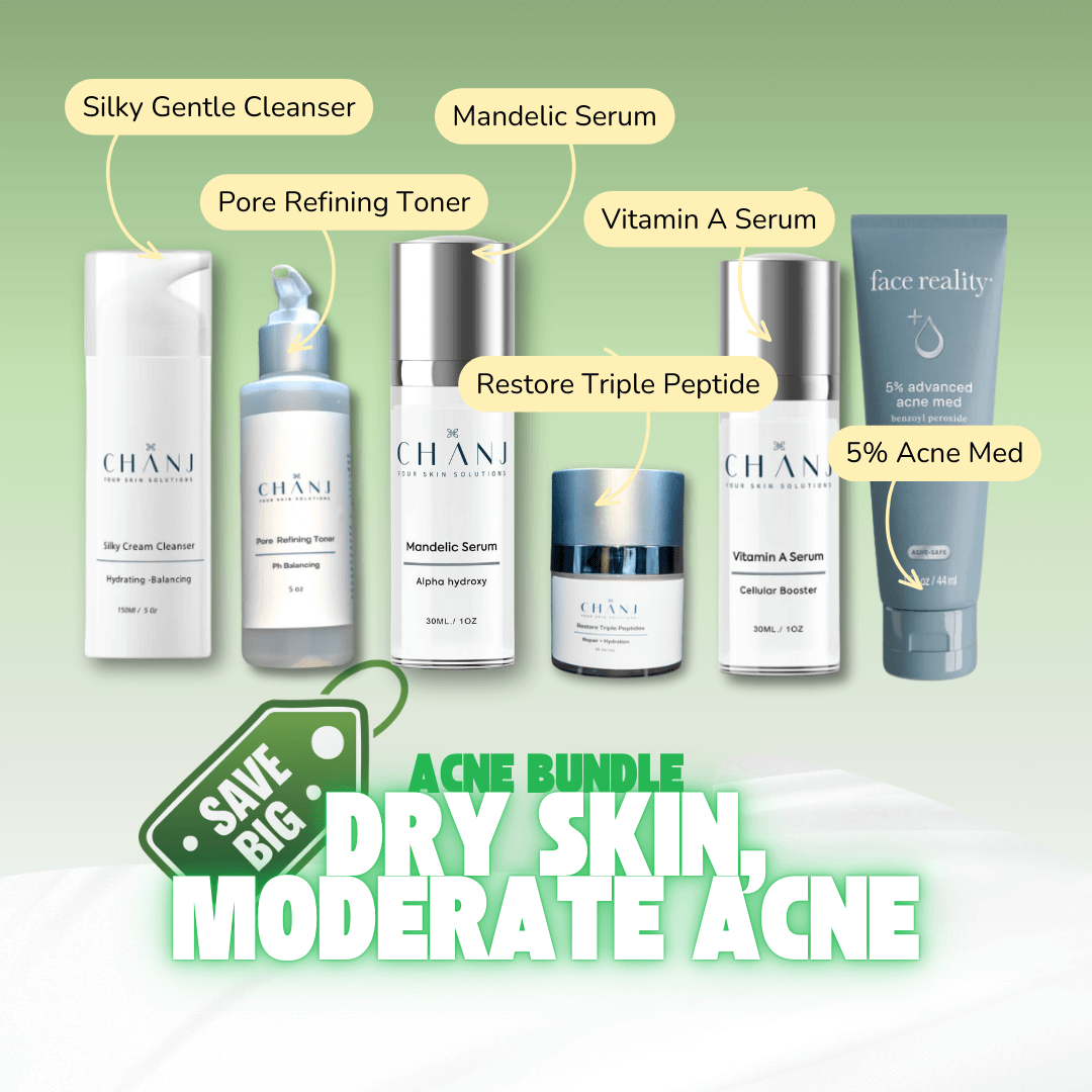 Chanj - Acne Bundle for Dry Skin, Moderate Acne - Skin Essence by Kathy
