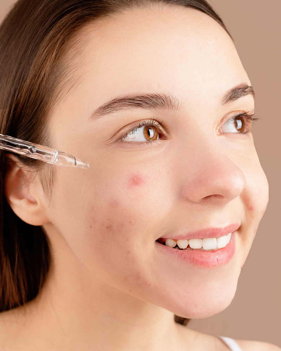 Ekseption - Hylauronic ZNPCA