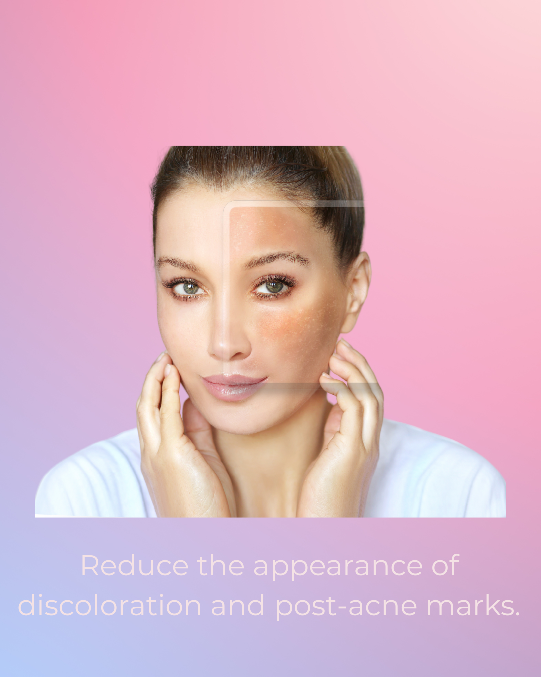 Derma.mentor Clear Skin Balancing Essence