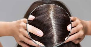 How can I get benefits for my scalp?