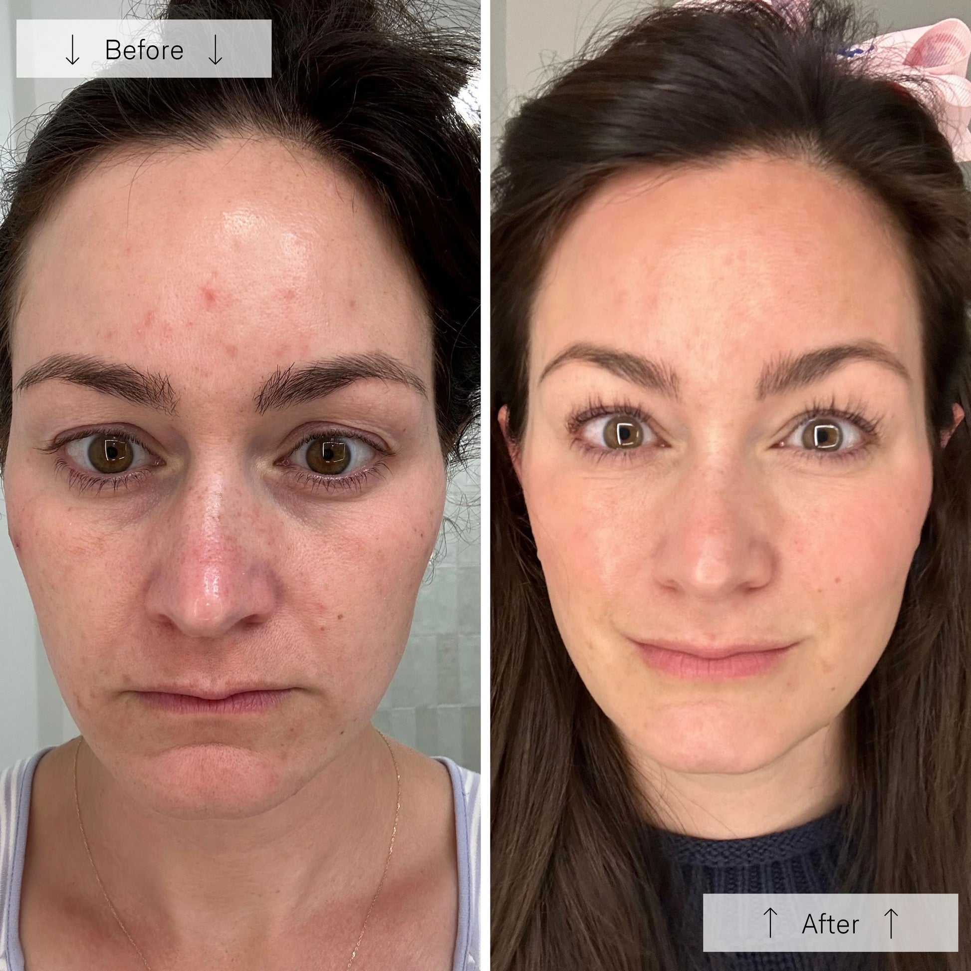 Omnilux Contour Face - Skin Essence by Kathy