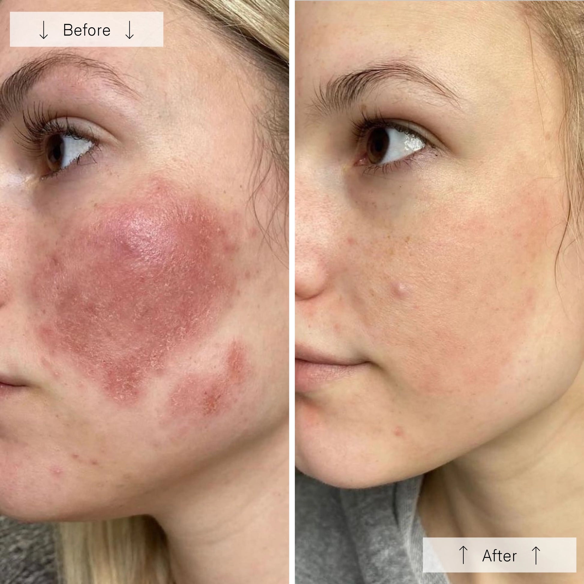 Omnilux Contour Face - Skin Essence by Kathy