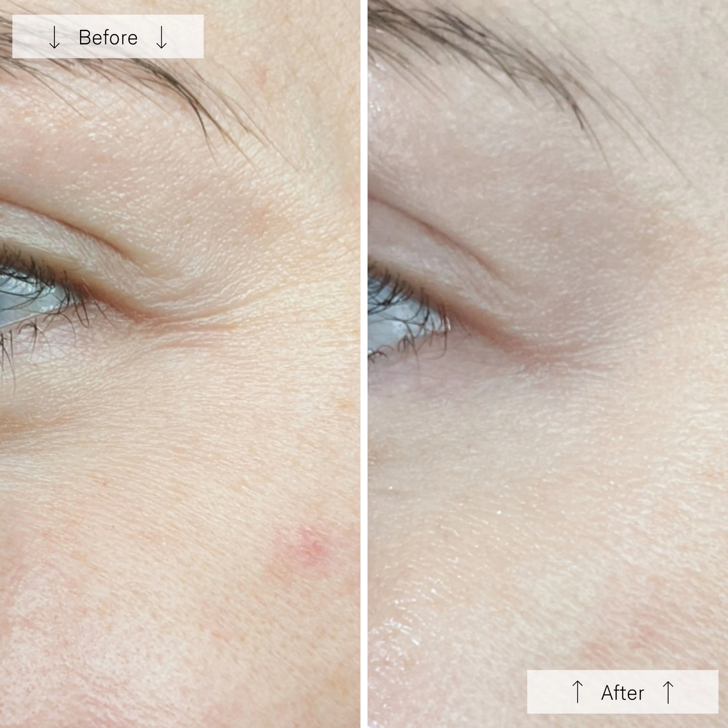 Omnilux Contour Face - Skin Essence by Kathy